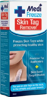 Medi-Freeze-Skin-Tag-Remover-38mL on sale